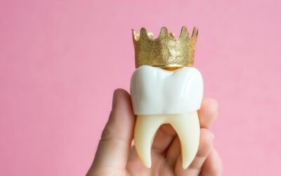 Czym właściwie jest korona na ząb i kiedy jest potrzebna?