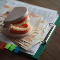 Ile kosztuje bonding zęba i czy warto się na niego zdecydować?