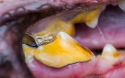 Jak odróżnić kamień nazębny od próchnicy?