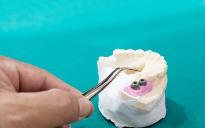 Czy usuwać kamień z zębów samodzielnie?