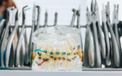 Ortodoncja Bielsko: dlaczego wczesna diagnoza jest kluczowa? Najczęstsze wady zgryzu u dzieci