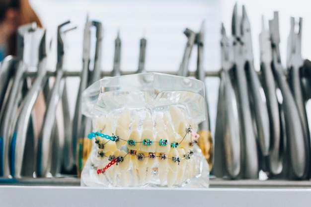 Ortodoncja Bielsko: dlaczego wczesna diagnoza jest kluczowa? Najczęstsze wady zgryzu u dzieci